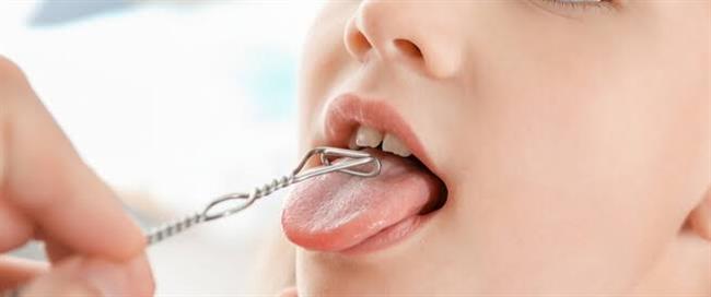 اسباب ثقل اللسان