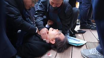 زعيم المعارضة في كوريا الجنوبية يتعرض لحادث طعن