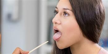 تعرف على أسباب إصفرار اللسان