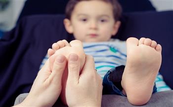 للأمهات.. 6 طرق طبيعية لعلاج فطريات القدم لدى أطفالك