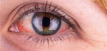 تأثير ارتفاع ضغط الدم على العين