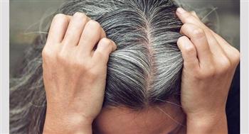 للسيدات.. 6 علاجات طبيعية عند ظهور الشعر الأبيض المبكر