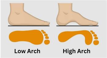 في لغة الجسد.. شكل قدميكِ يدل على سماتك الشخصية