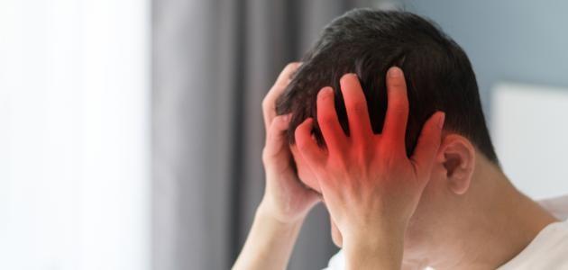 تعرف علي أنماط وأسباب الصداع اليومي المزمن