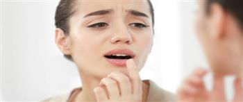 اسباب تكرار التهاب الفم