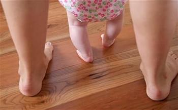 أسباب تقوس ساق الأطفال