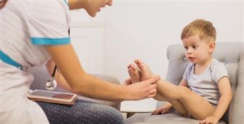 أبرزها تأخر النمو وضعف العضلات.. تعرف علي أعراض الكساح «ليونة العظام» 