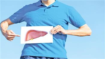 دراسة سويدية جديدة تشير إلى العلاقة بين الكبد الدهني والعدوى الشديدة