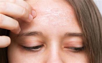 6 أسباب شائعة لجفاف جلدك وبشرتك.. بخلاف شرب المياه