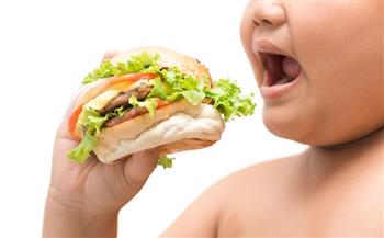خبيرة تغذية توضح أسباب سمنة الأطفال وطرق وقايتهم