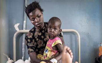 الكاميرون تسجل انخفاضا ملحوظًا في معدل الوفيات الناجمة عن الملاريا بين 2019 و2023