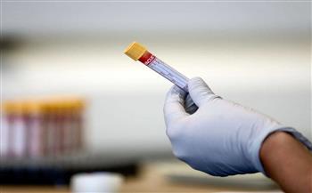 دراسة: تطوير اختبار دم يسهم فى تشخيص مبكر لحالات سرطان البنكرياس بدقة 97٪