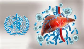 الصحة العالمية: التهاب الكبد الوبائي يحصد 3500 شخص يوميا