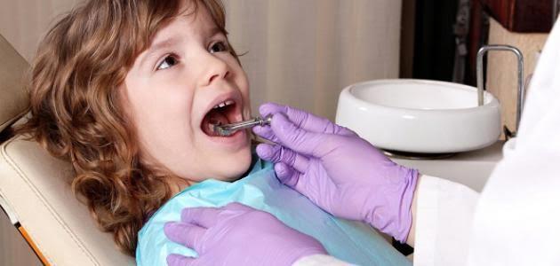 انتبهوا..عادات خاطئة تزيد من تسوس الأسنان عند الأطفال
