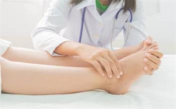 لهذه الأسباب تصاب النساء بتورم القدمين