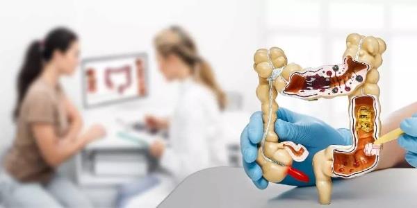 لصحة القولون .. اتبع هذه الاستراتيجية الغذائية