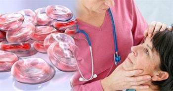 أعراض نقص الحديد الأكثر شيوعاً