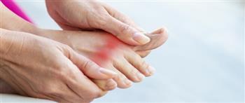 "داء الملوك" ..كيف يمكن الوقاية منه؟