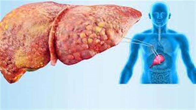 تعرف على الكبد الدهني..ومضاعفاته