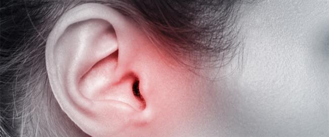 ماذا تعرف عن تسوس الأذن الوسطى؟