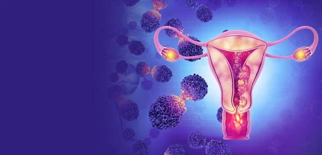 5  مضاعفات لسرطان عنق الرحم