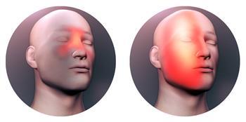 تعرف على الفرق بين الصداع النصفى وصداع الجيوب الأنفية