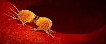 انتبه..أطعمة قد تسبب  الإصابة بالسرطان