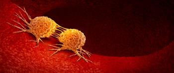 انتبه..أطعمة قد تسبب  الإصابة بالسرطان