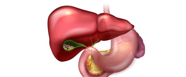 5 علامات تشير  إلى مشكلة في المرارة!