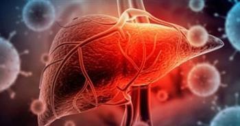 كيف يسبب السكري أمراض الكبد..؟