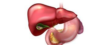 هذه هي أعراض إلتهاب المرارة