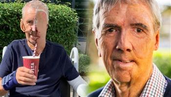 استعاد ملامحه.. بريطاني يحصل على أول وجه مطبوع بتقنية ثلاثية الأبعاد