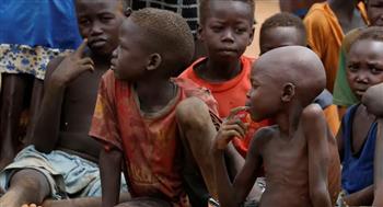 الصحة العالمية: 770 ألف طفل في السودان يعانون سوء تغذية حادًا 