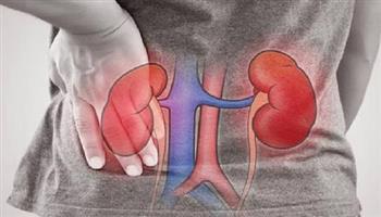 علامات وجود حصوات في الكلى