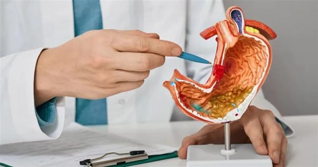 في هذه الحالة يجب  التدخل الجراحي لعلاج جرثومة المعدة 