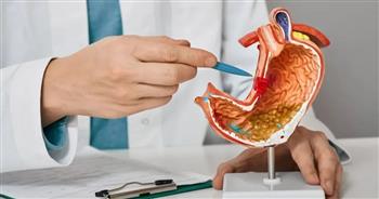 في هذه الحالة يجب  التدخل الجراحي لعلاج جرثومة المعدة 