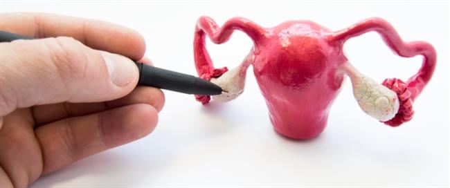 5   أطعمة  هامة لمتلازمة تكيّس المبايض