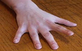 للتخلص من أوجاع أصابع اليد الناتجة عن إمساك الهاتف.. مارسي هذه التمارين