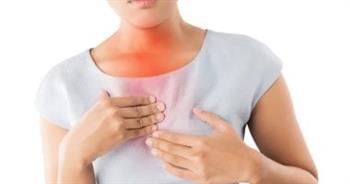 تعرف على أعراض ارتجاع المرئ .. أهمها ألم وحرقة المعدة