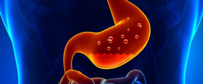 تعرف علي أساب الارتجاع الحنجري