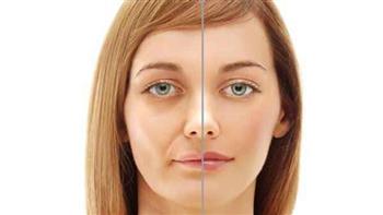 أسباب وأعراض الإصابة بالتهاب العصب السابع