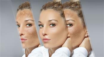 انتبه ...مسببات تضعف حاجز بشرتك