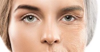 تعرف على  قوس الشيخوخة ! 