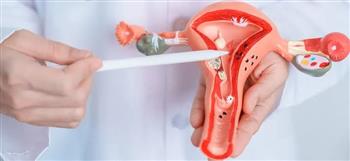 هذه العوامل سببًا في الإصابة ببطانة الرحم المهاجرة