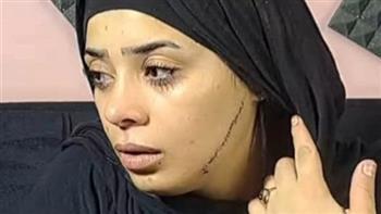 اليوم.. نظر محاكمة المتهمة بتشويه وجه عروس مصر القديمة