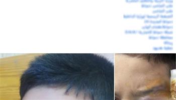 ضبط مدرس اعتدى على طالب بعصى خشبية في دمياط