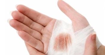 طرق منزلية للتعامل مع الجروح