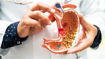 أعراض الإصابة المزمنة بجرثومة المعدة