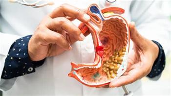 أعراض الإصابة المزمنة بجرثومة المعدة