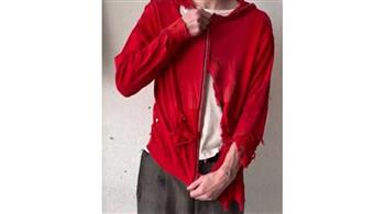 "الجمال يكمن في العيوب".. سترة ممزقة بـ950 دولارًا| صور